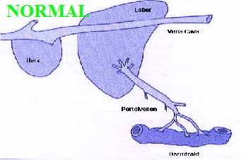 NORMAL